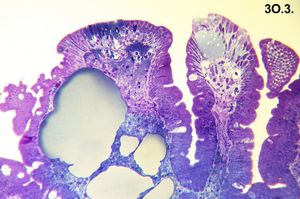 Whipple disease - cured(semithin section) Whipple disease - cured(semithin section)